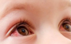 Основные причины покраснения глаз у ребёнка – когда обращаться к врачу?