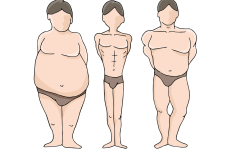 Как худеть правильно по типу телосложения?