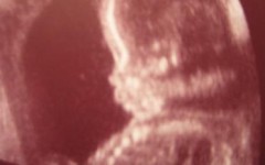 Беременность 23 недели – развитие плода и ощущения женщины