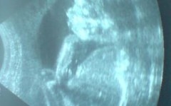 Беременность 24 недели – развитие плода и ощущения женщины