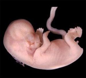 What does a fetus look like at 11 weeks of gestation