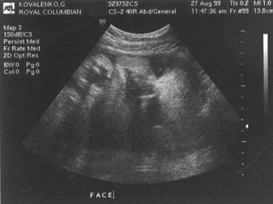 Pregnancy Week 42 - Fetal Development and Mother's Feelings