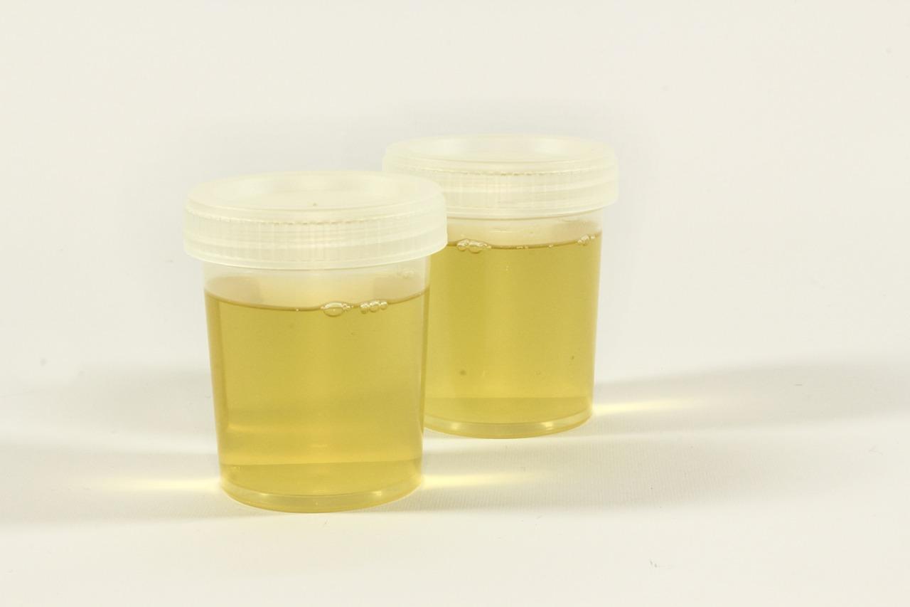 urine