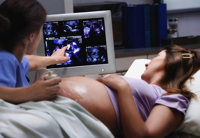 Breech presentation of the fetus - cesarean section and vaginal delivery