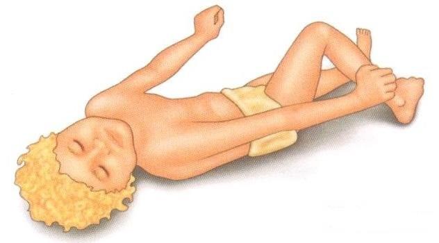 Febrile seizures in children - treatment