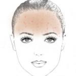 What do pimples on the forehead say?