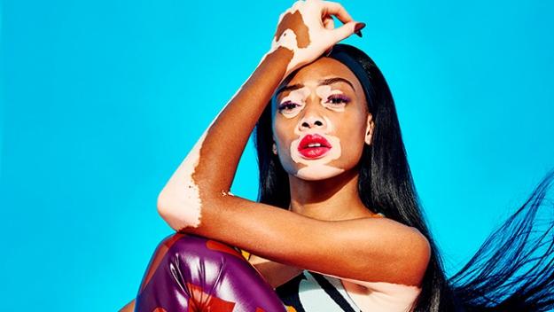Winnie Harlow