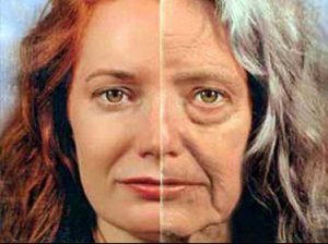 Deformation type of aging