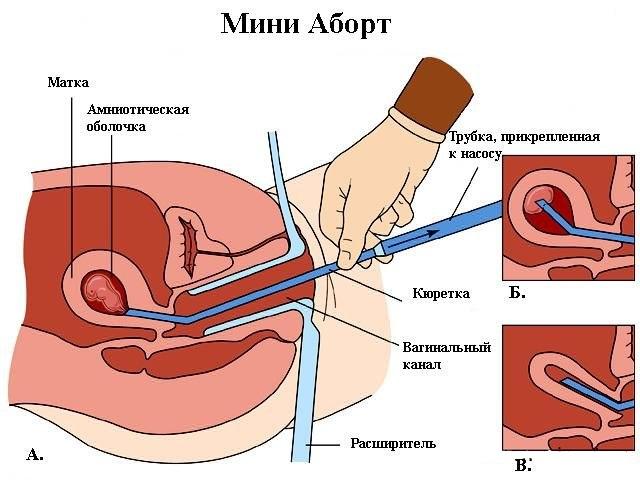 Его Его